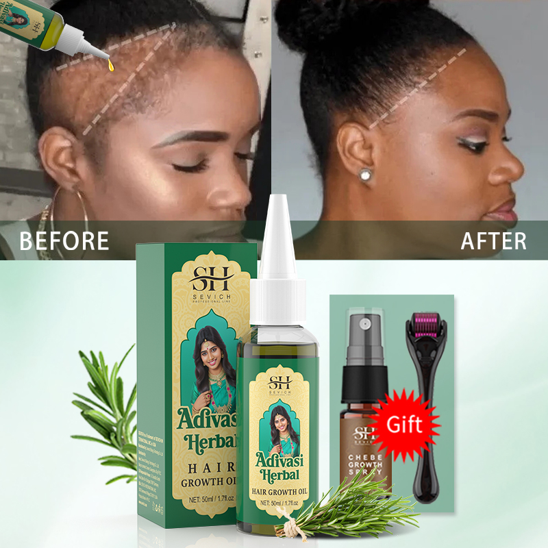 Ayurveda Saç Uzatma Yağı Hindi - Ingrown Hair Serum incelemesi ve fiyatı