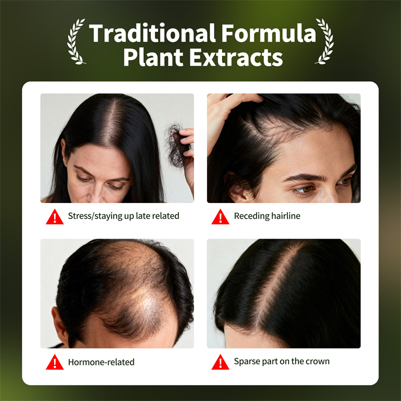 Doğal Saç Çıkarma Seti Usman Ç - Ingrown Hair Serum incelemesi ve fiyatı