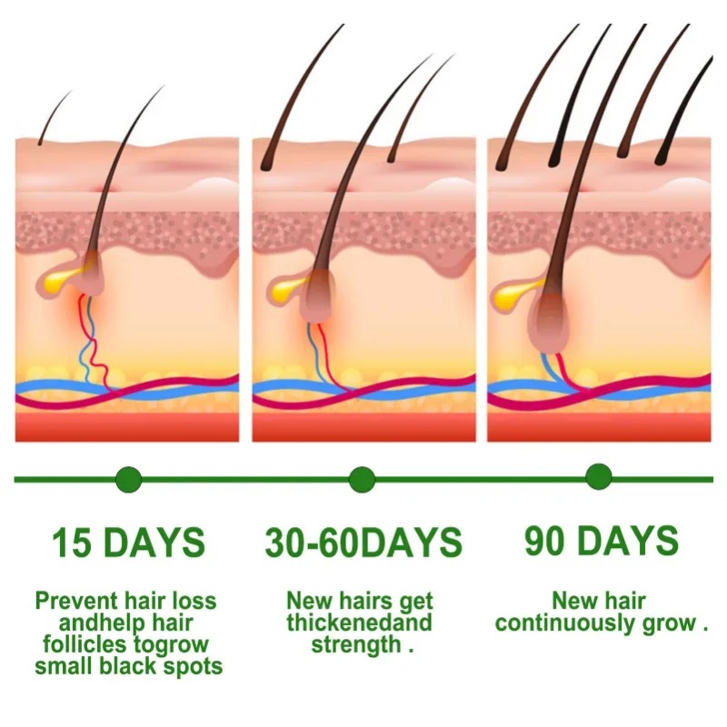 Saç Büyüme Serumu Hızlı Büyüye - Ingrown Hair Serum incelemesi ve fiyatı