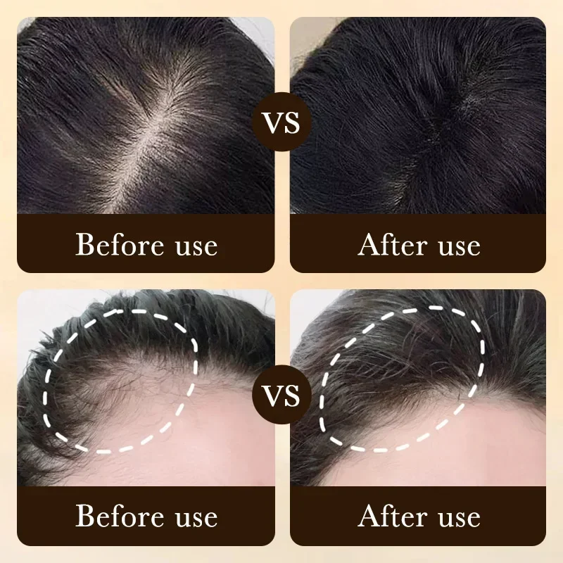 Biotin Hızlı Saç Uzatma Yağı Ü - Ingrown Hair Serum incelemesi ve fiyatı