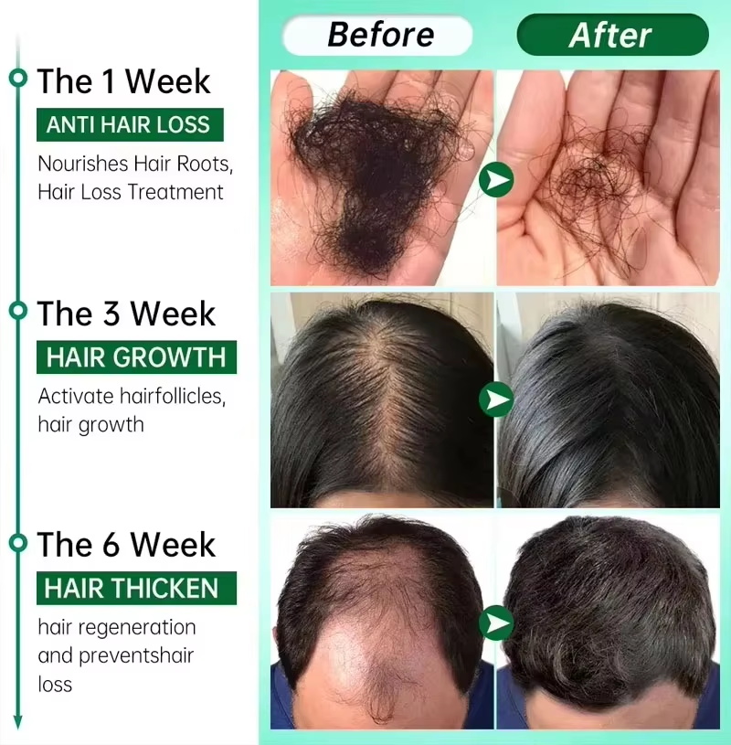 Saç Büyüme Serumu 7 Gün Hızlı  - Ingrown Hair Serum incelemesi ve fiyatı