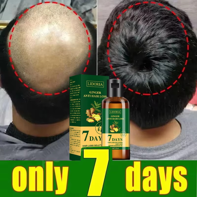 Saç Büyüme Serumu 7 Gün Hızlı  - Ingrown Hair Serum incelemesi ve fiyatı