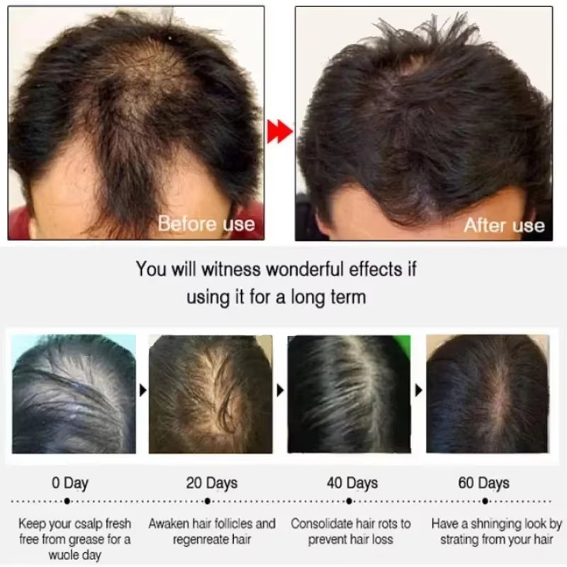Saç Büyüme Serumu 7 Gün Hızlı  - Ingrown Hair Serum incelemesi ve fiyatı