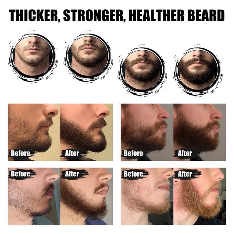 5 adet Erkekler Sakal Barba Ba - Men'S Grooming Tonic incelemesi ve fiyatı