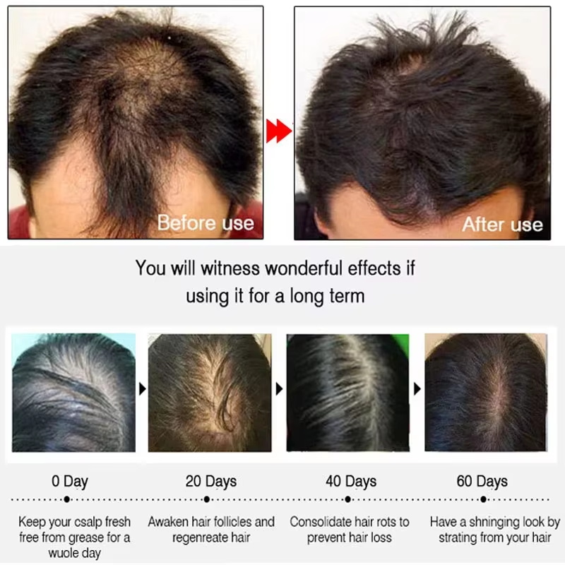Hızlı Zencefilli Saç Uzatma Sp - Ingrown Hair Serum incelemesi ve fiyatı