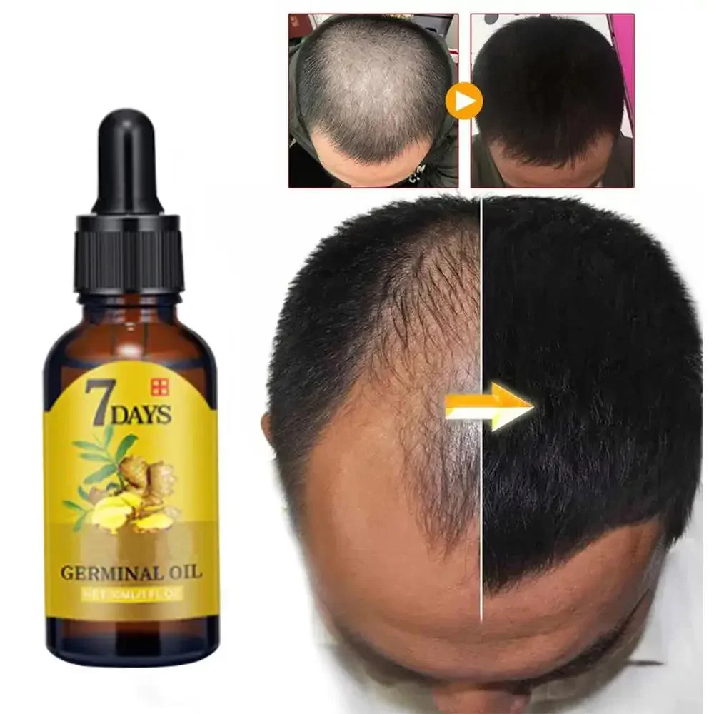 Saç Büyüme Zencefil Hızlı Büyü - Ingrown Hair Serum incelemesi ve fiyatı