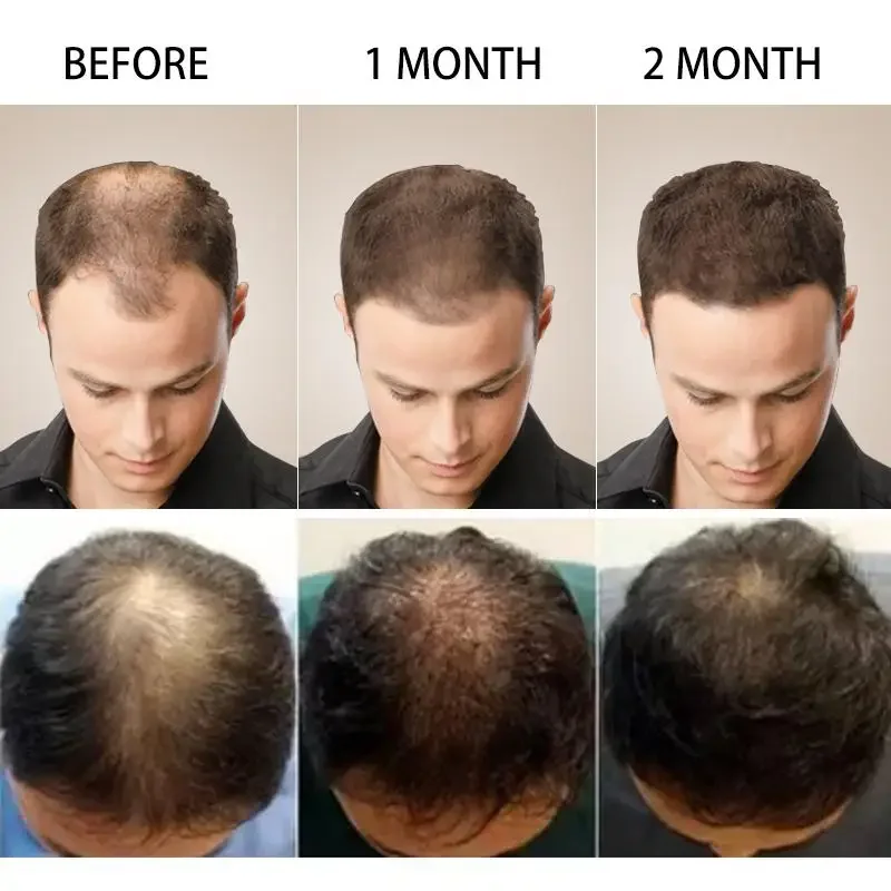 Saç Büyüme Zencefil Hızlı Büyü - Ingrown Hair Serum incelemesi ve fiyatı